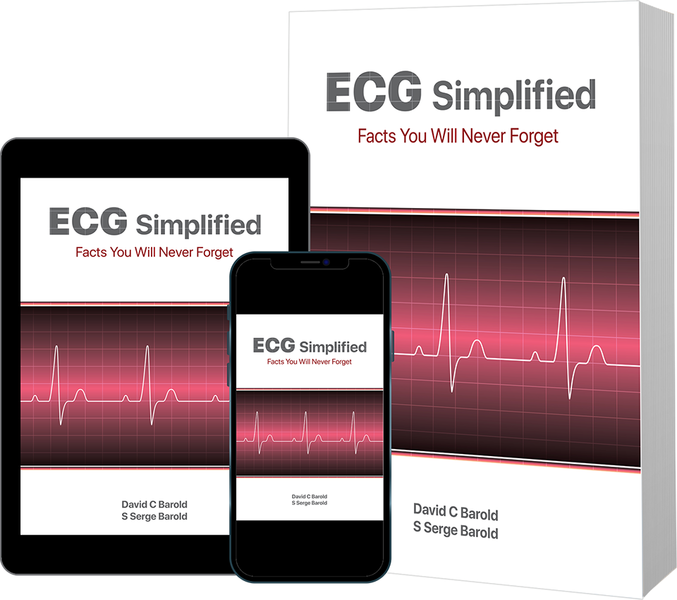 Electrocardiogram interpretations